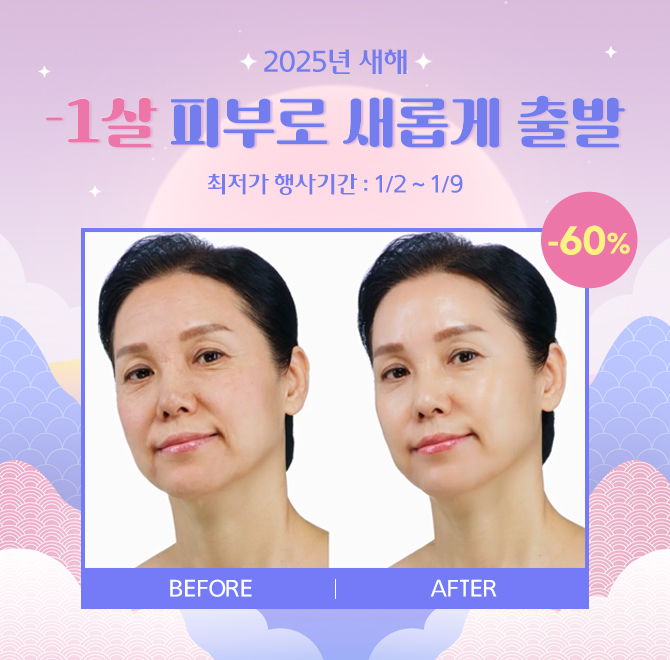 새해 최대 할인 1살 피부로 새롭게 출발리비힐 엑소좀 크림은 14년 개발 독점 성분 엑소좀이 함유되어 있는 제품으...